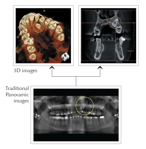 3D Imaging - Dentist Greensburg, PA